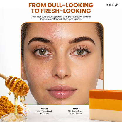 Glow Naturally Turmeric Soap with Shea Butter, Honey & Kojic Acid
